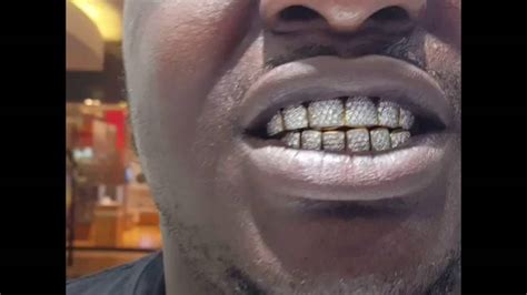 Gold Teeth With Diamonds - YouTube