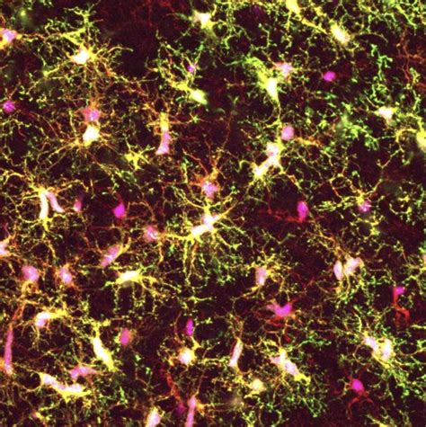 Whitehead Institute team develops new method to study human brain cells ...