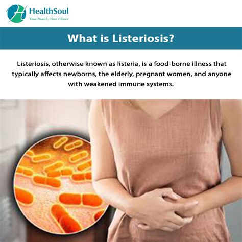 Listeriosis: Symptoms and Treatment – Healthsoul