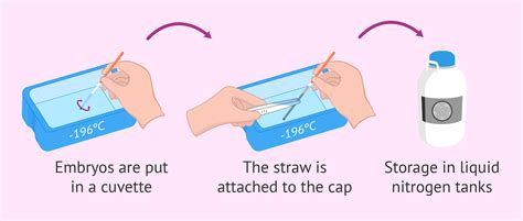 What is embryo vitrification? How and when is this procedure used?