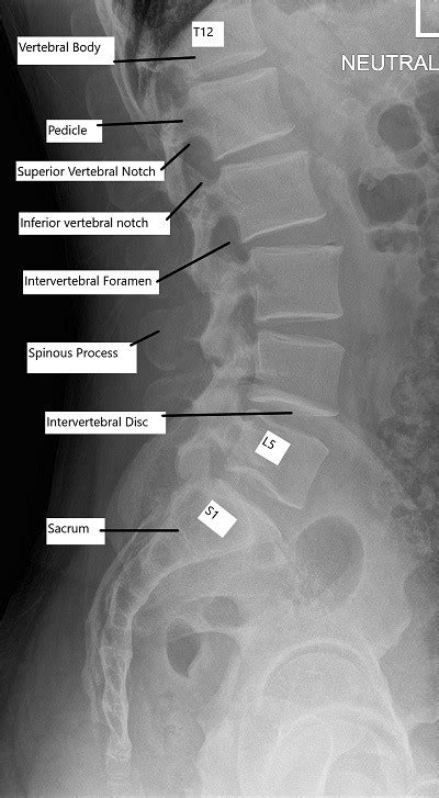 Cervical Spine X Ray Anatomy