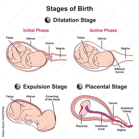 Stages of baby birth infographic diagram onset of labour flexion ...