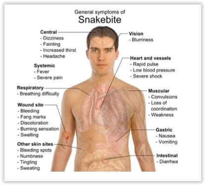 Snake bite - first aid - Sentinel Consultancy