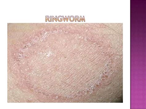 most common skin diseases - pictures, photos