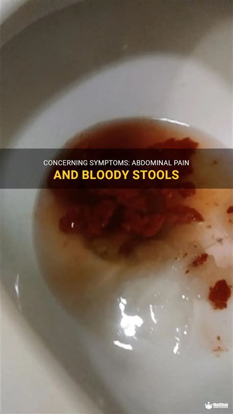 Concerning Symptoms: Abdominal Pain And Bloody Stools | MedShun