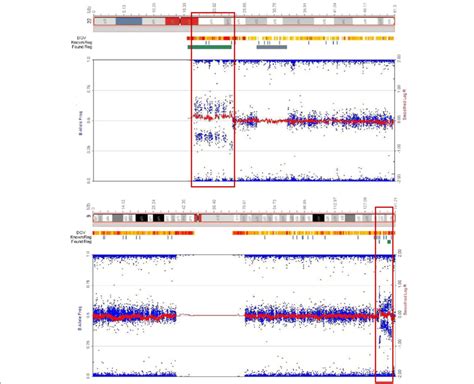 SNP microarray analysis of bone marrow sample of patient at diagnosis ...