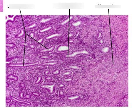 uterus histology 1 Diagram | Quizlet