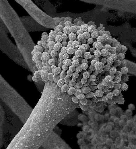 Aspergillus fumigatus [IMAGE] | EurekAlert! Science News Releases