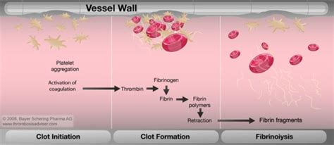 Coagulation Issues: Fibrinolysis & HIT: Helpful Graphics - Perfusion.com