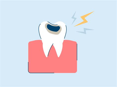 Cavity Pain: Relief, Symptoms, and Causes