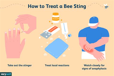 Bee Sting: What Treatments and Remedies Actually Work