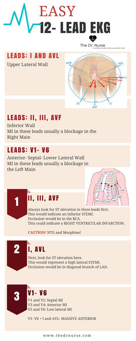 Best Way To Learn 12 Lead Ecg - Just For Guide