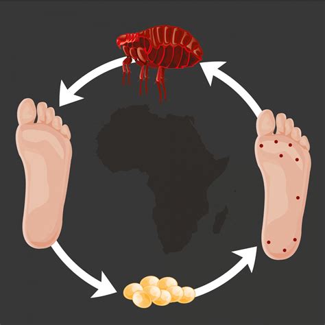 Sand Flea Bites on Humans – Pictures, Treatment and Prevention