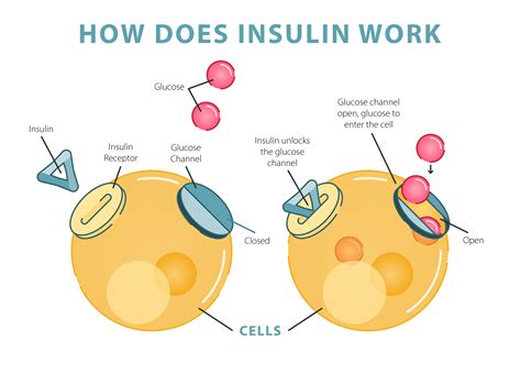 For Kids: What is Diabetes? - Children with Diabetes