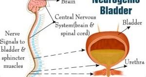 My Family Medicine Practice: Introduction to Neurogenic bladder