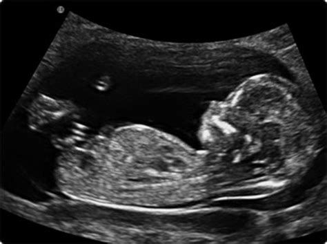 Ultrasound Level One Services – Heavenly 3D 4D Ultrasound