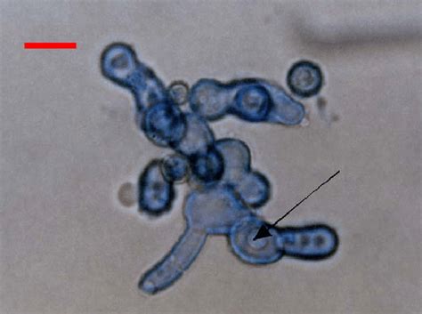 Spores of Aspergillus sp. (isolate # 3454) germinating at 300 bar/30 ...