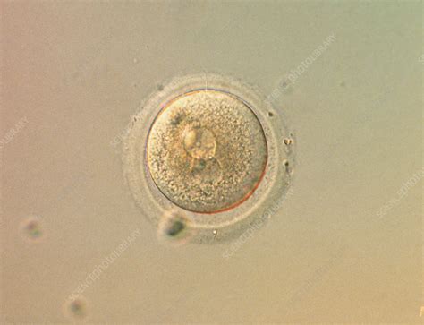 LM of human zygote during in-vitro fertilisation - Stock Image - P648 ...