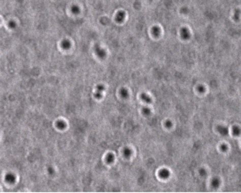 Streptococcus Capsule Stain