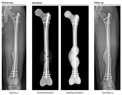 JCM | Free Full-Text | Computer-Based Mechanobiological Fracture ...