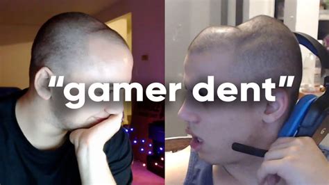 What Is The Dreaded 'Gamer Dent'? The Meme Mocking A Headphone-Shaped ...