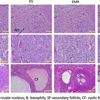 Histology of the hypothalamus, pituitary, and ovary. The... | Download ...