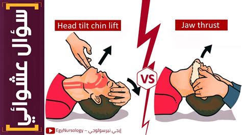 سؤال عشوائي | (8) الفرق بين الـ (Head tilt chin lift) و (Jaw thrust ...