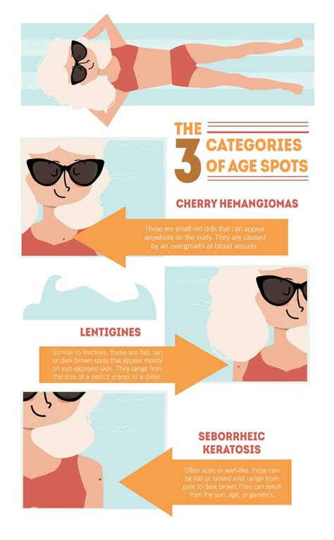 All About Age Spots: Causes, Treatment, and Prevention