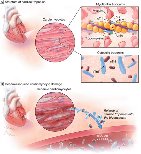 troponin: Latest news, Breaking headlines and Top stories, photos ...