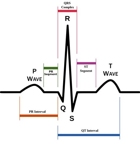 Understanding the EKG Signal - Atrial Fibrillation: Resources for Patients