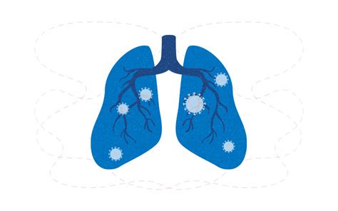 What drives severe lung inflammation in COVID-19? - Boston Children's ...