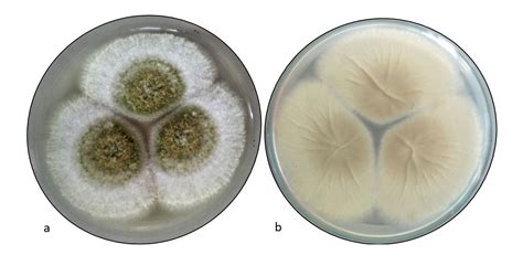 Aspergillus flavus – Facesoffungi number: FoF 09597 - Faces Of Fungi