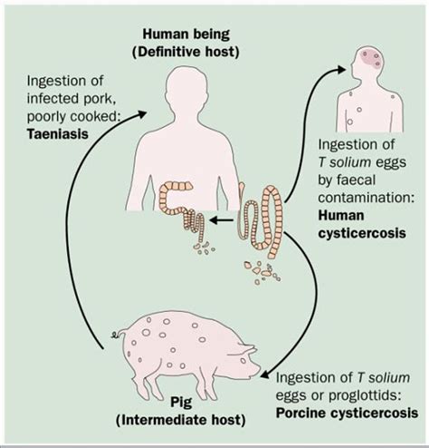 Grim images show parasitic worms crawling underneath Vietnamese woman's ...