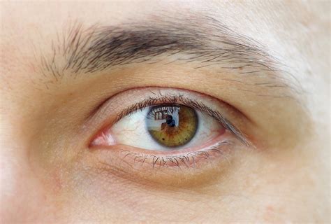 File:Eye closeup.jpg