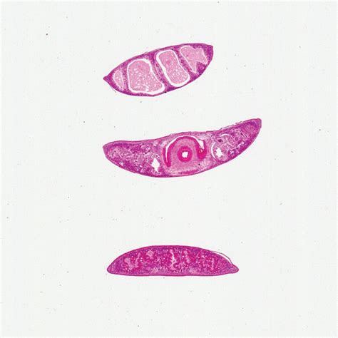 Planaria, c.s., Three Different Body Regions Microscope Slide ...