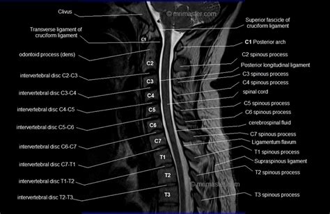 mri cervical spine sagittal anatomy