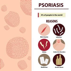 Psoriasis Vs Eczema: Let's Understand The Difference