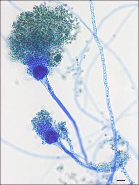 Aspergillus Fumigatus