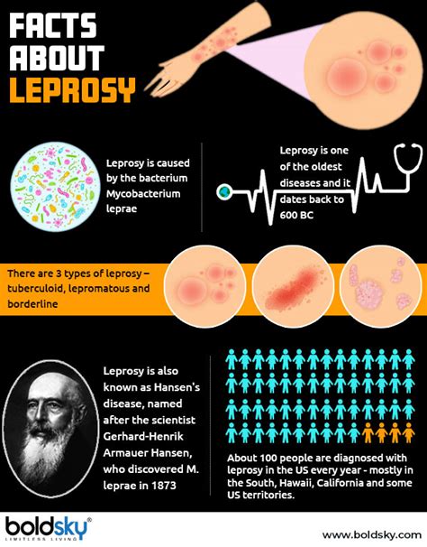 Leprosy: Types, Causes, Diagnosis & Treatment - Boldsky.com