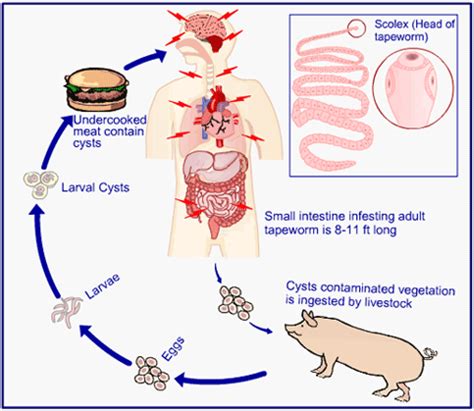 Tapeworm Infections - Types - Symptoms - Diagnosis - Prevention - Treatment