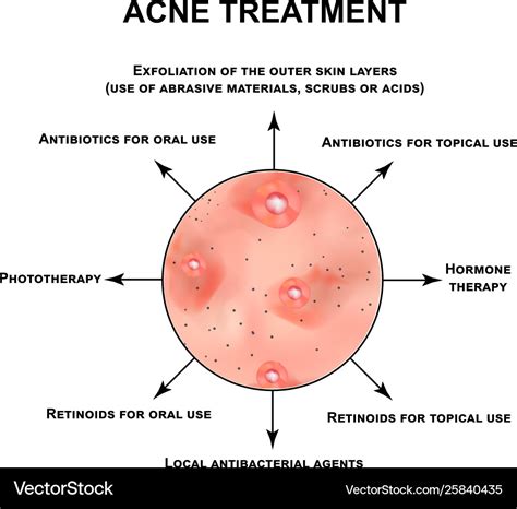 Acne treatment pustules papules comedones Vector Image