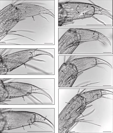 Stages of the moult cycle of Gammarus pulex based on the observation of ...