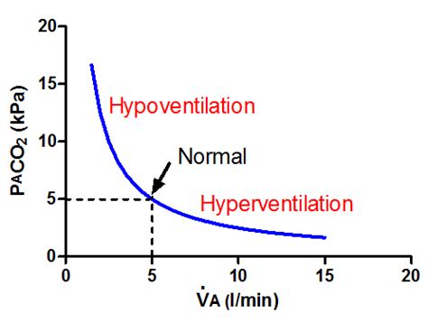 Hypoventilation; hypoventilations