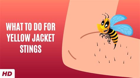 What To Do For Yellow Jacket Stings - YouTube