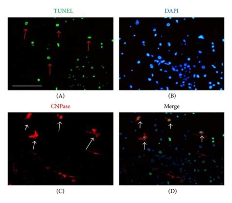 Expression of cyt-c in each group detected by western blot. (a) 3-day ...