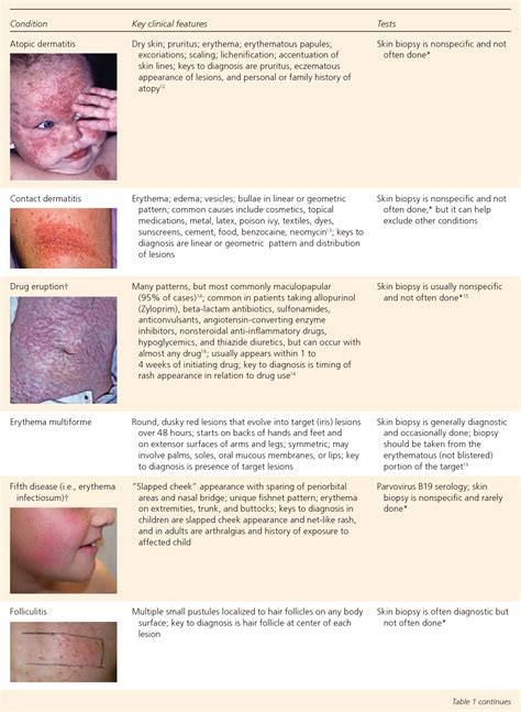 [PDF] The generalized rash: part I. Differential diagnosis. | Semantic ...