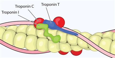 Troponin Levels: What High Levels Mean, Tests, Normal Range - Dr. Axe