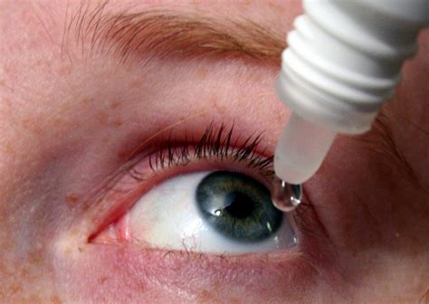 Loteprednol Suspension Eye Drops Reduce IOP Following Corneal ...