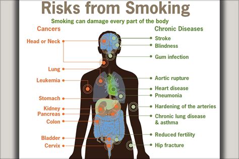 24"x36" Gallery Poster, health Risks from smoking cdc diagram cancer ...