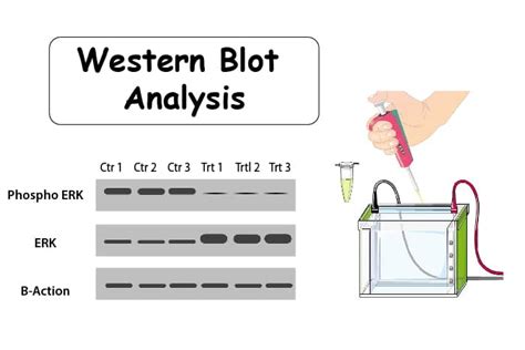 All you need to know about the Western Blots and their importance in ...